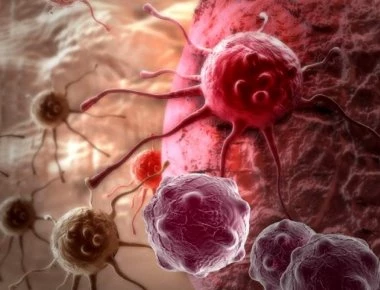 Έλληνας ερευνητής και η ομάδα του κατάφεραν να «σκοτώσουν» τον καρκίνο του μαστού - Έσωσαν γυναίκα στο τελικό στάδιο!